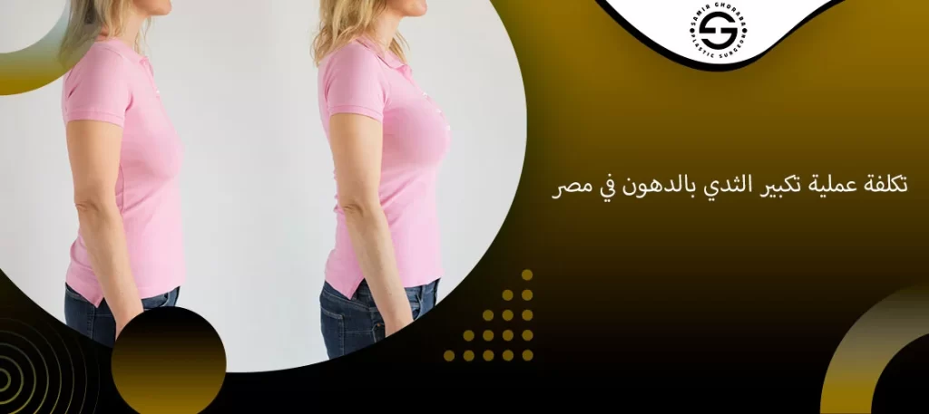 تكلفة عملية تكبير الثدي بالدهون في مصر