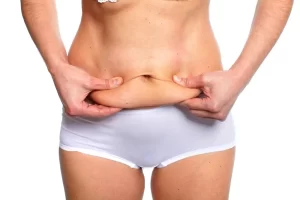 safe weight for a tummy tuck