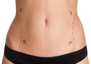 Benefits of Body Contouring Surgery