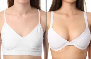 Benefits of Breast Lift Surgery