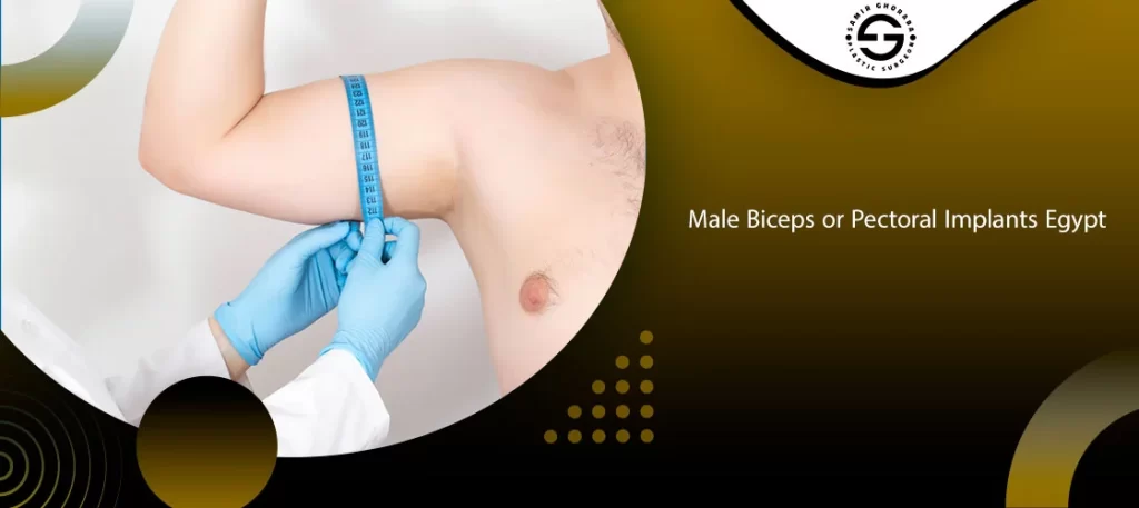 Male Biceps or Pectoral Implants Egypt