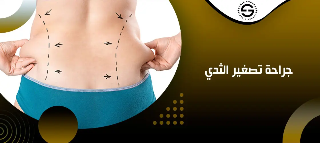 Different Types of Liposuction