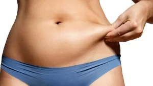 best type of liposuction