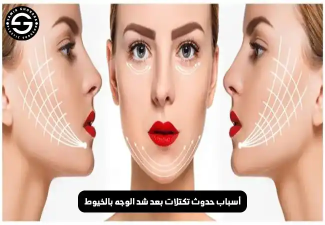 أسباب حدوث تكتلات بعد شد الوجه بالخيوط